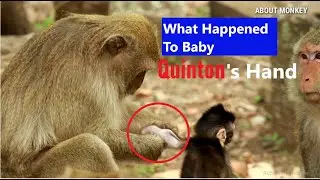 WHAT  HAPPEN ON CUTE BABY QUINTON ? WHY QUINTON SO LOVELY AND BECOME LIKE THIS?