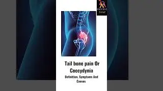 Tail Bone Pain / Coccydynia #definition #symptoms #causes #tailbone #coccydynia   #shortsfeed