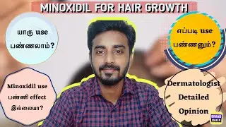 Minoxidil for Hair growth || யாரு use பண்ணலாம்? எப்படி use பண்ணனும்? Detailed video || DermaTalks
