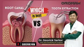 Root Canal vs Extraction: The Truth Dentists Don&rsquo;t Tell You! | Dr. Souvick Sarkar (Oromax Siliguri)