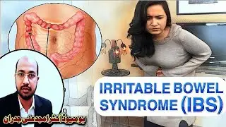 Irritable Bowel Syndrome (IBS) Explained: Causes, Symptoms & Treatment | Dr. Jadran #ibs 