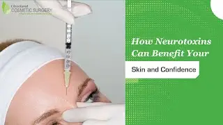 How Neurotoxins Can Benefit Your Skin and Confidence