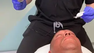 Cosmelan | Depigmentation Peel | Skin Texture and Pigmentation | West Hollywood, CA | Dr. Jason Emer