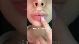 Lip set: #WW281583 vb (all 4 products in 1 set) 👄💉 Less than 1000 rubles for plump lips 🤍 RP