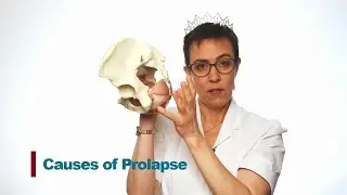 Pelvic Organ Prolapse: Why Do You Have It?