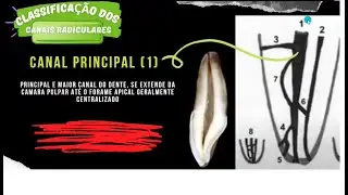 Classificação dos Canais Radiculares