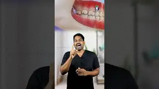 Why should you remove a painless upper wisdom tooth? Why to extract upper wisdom tooth? Dr.Karthi...