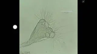 Secret Life of Bugs: Suctoria 1