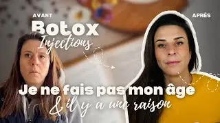 Il para&icirc;t que je ne fais pas mon &acirc;ge &hellip; [Botox, acide hyaluronique and co &hellip;]