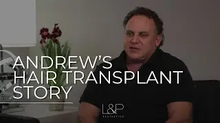 My Bay Area NeoGraft Hair Transplant Story - From Hair Loss to Restored Confidence