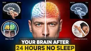 Your Brain On No Sleep