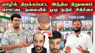 🔴இந்தியாவில் இருந்து யாழ்ப்பாணம் வந்த தலைமுடி மாற்று சிகிச்சை நிலையம் 😮🔥💇‍♂️ Hair Transplantation 🇮🇳