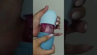 Will you try this Ice roller?❤️#shorts #icing #skincare