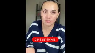 Bu Kadarına Pes Diyeceksiniz! Ne Yapmış?! 