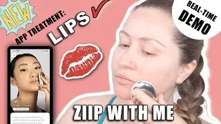 Процедура для увеличения объема губ ZIIP HALO💋 | до и после