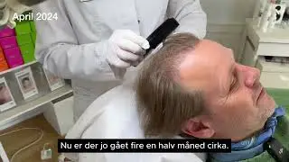 PRP med Tomas Villum Jensen