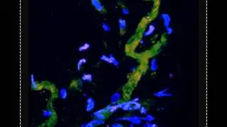 Functional microvasculature formation in UCBMSC-seeded Matrigel implanted in mice.