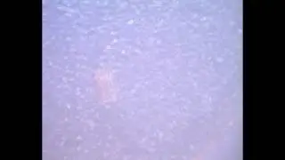 Flour mite