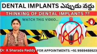 Things to Consider Before Dental Implants || Pros and Cons of Dental Implants || Dr. K Sharada Reddy