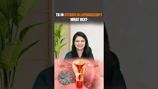 TB in Uterus Detected During Laparoscopy | What Happens Next? Complete Treatment Guide