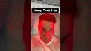 Hair Loss Treatment That Works #menshairloss #malepatternbaldness