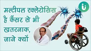 मल्टीपल स्क्लेरोसिस है कैंसर से भी खतरनाक, जानें क्यों Dr Rahul Bhargava से