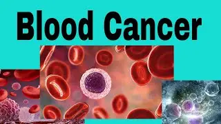 Blood cancer 