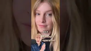 БЕЗУМНАЯ пластическая операция: трансформация | Реакция пластического хирурга