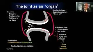 Knee Osteoarthritis: Using Biology to Optimize Exercise