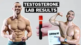 How to Increase Your Testosterone Naturally (5 Tips)