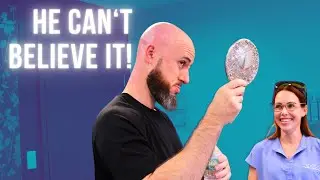 SCALP LASER HAIR REMOVAL FOR BALDING AND FULL FACE GROOMING | HE DROVE 8 HOURS FOR THIS!