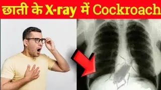 X-ray में cockroach || 5 most crazy facts in 1 min😲🤔🙄 || #shorts #youtubeshorts #facts #whatnewfacts