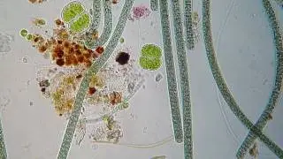 Oscillatoria & Cosmarium