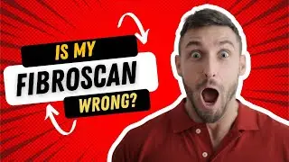 Is Your Liver Fibroscan Wrong? The Shocking Truth Fibroscan Accuracy