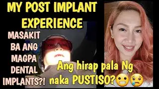 MY DENTAL IMPLANT JOURNEY PART 1