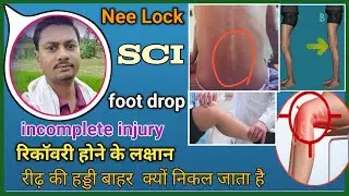 nee lock or foot drop problem after SCI.        how to exercise for spinal cord injure