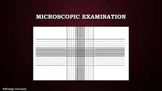 Microscopic examination of CSF | Cerebrospinal Fluid | Microscopy