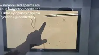 Live demonstration of Ovum pickup and ICSI