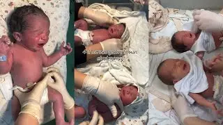 Yeni doğulan körpələr #baby #sweetbaby #comedy #tranding #bebek
