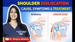 Shoulder Dislocation Hindi | shoulder dislocation treatment without surgery | Shoulder pain |