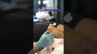 Scar Camouflage for Stretch Marks 💉 | Skin Tone Tattoo Neutralization Explained