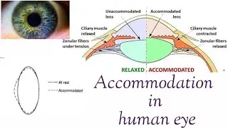 Lens Accommodation || Human eye || Made easy