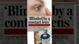 Colored Contact Lenses Safety Tips by Dr. Bhupesh Singh | Bharti Eye Hospital #bhartieyehospital