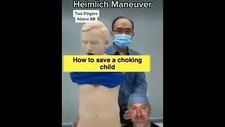 Choking First aid #shortsfeed #doctor #shortsvideo #short #mbbs