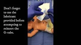 Gastrostomy Tube Accidental Dislodgement