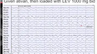 Trauma Case Vignettes: Case 3