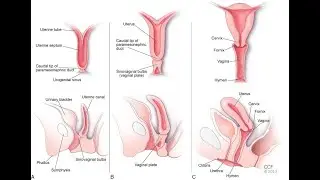 Failure of Embryonic female reproductive structures to disappear