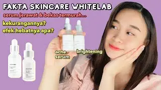FAKTA SKINCARE WHITELAB | Kekurangan, kelebihan, first impression