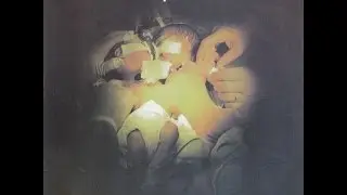 Dahmer - Split 7