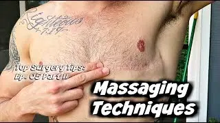 Top Surgery Tips Ep. 05: Part II- Scar Creams & Massage